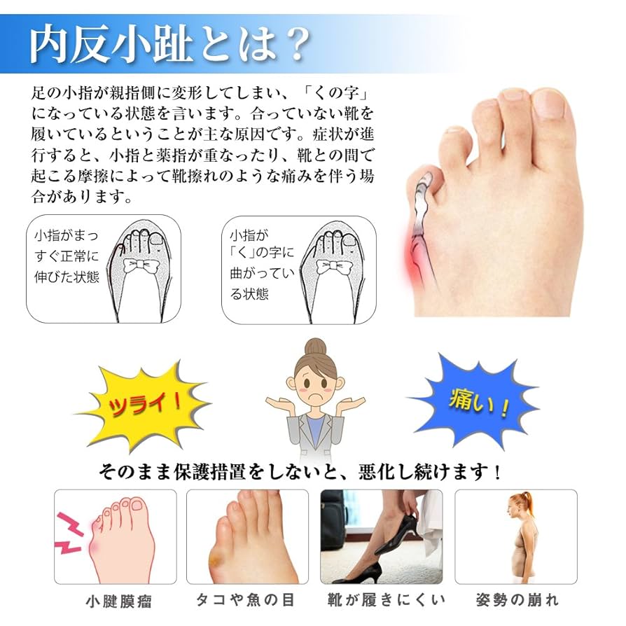 Amazon | 内反小趾 サポーター，医療用シリコンパッド 靴ズレ